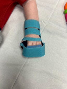 Splint by Carley Yanuck on infant